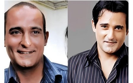 The Secret Behind Bollywood’s Perfect Hair? Why Hair Patches Are Becoming the Go-To Solution