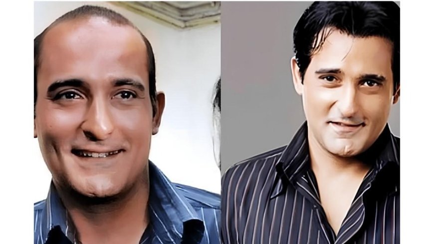 The Secret Behind Bollywood’s Perfect Hair? Why Hair Patches Are Becoming the Go-To Solution